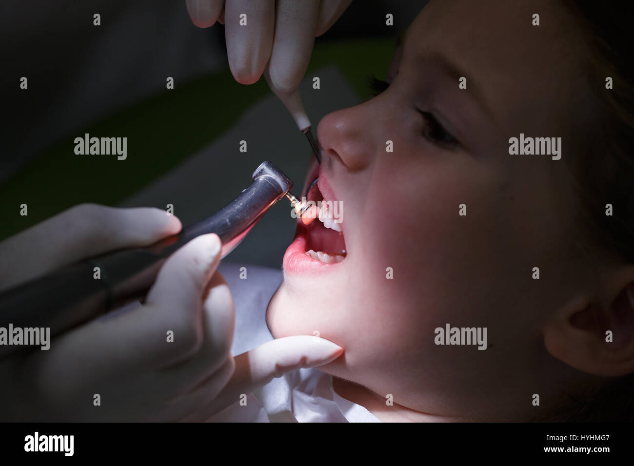 Bambina al dentista pediatrico office, ottenendo il suo denti lucidati con trattamento profilattico incolla dal suo dentista. La prevenzione precoce, igiene orale, paura di d Foto Stock