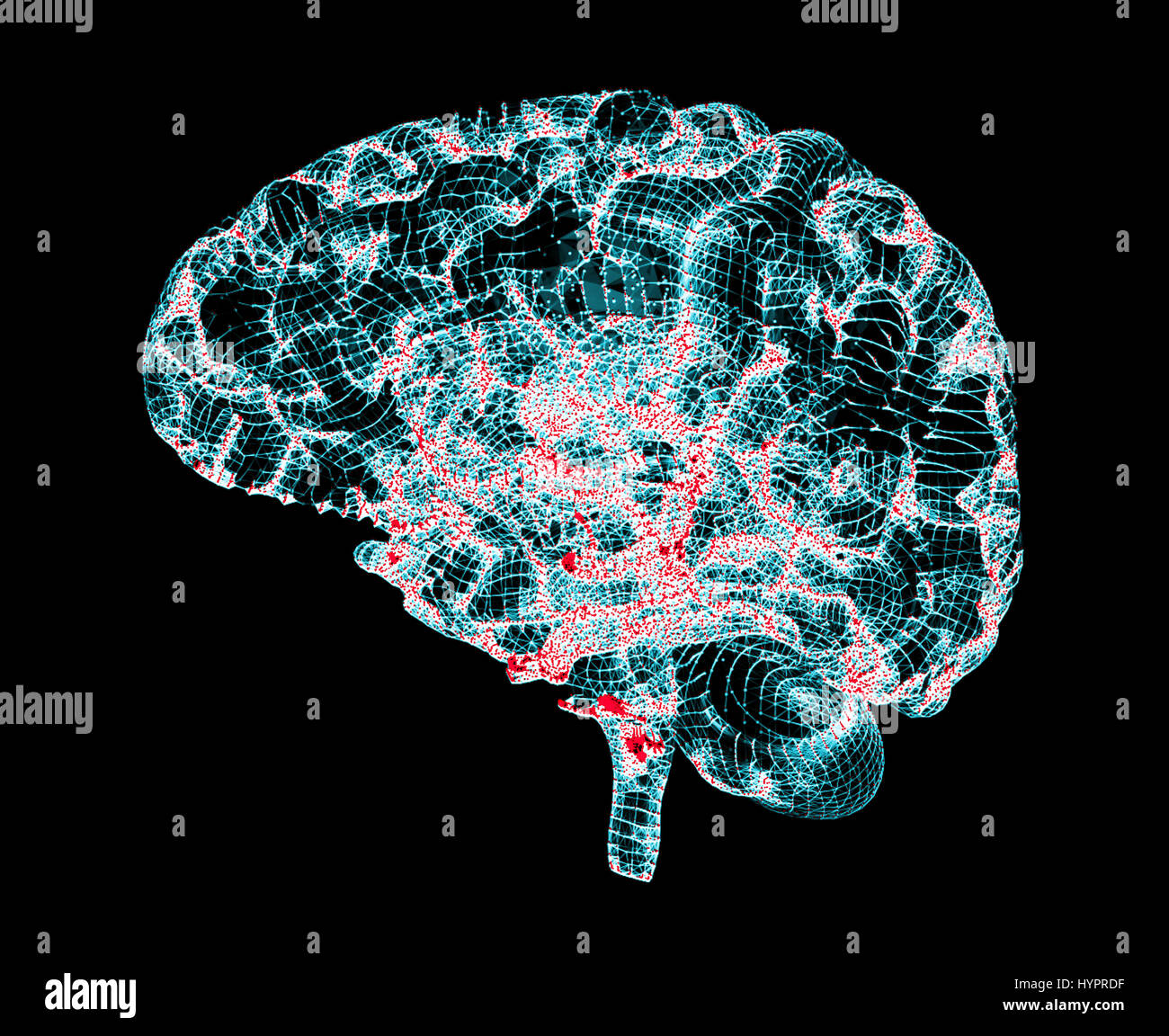 Cervello malattie degenerative, morbo di Parkinson, Sinapsi, neuroni, il morbo di Alzheimer, rendering 3D Foto Stock