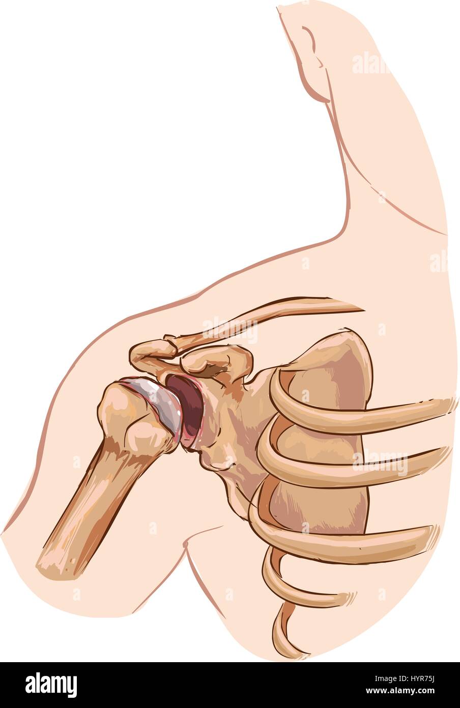 Sfondo bianco illustrazione vettoriale di una dislocazione della spalla Illustrazione Vettoriale