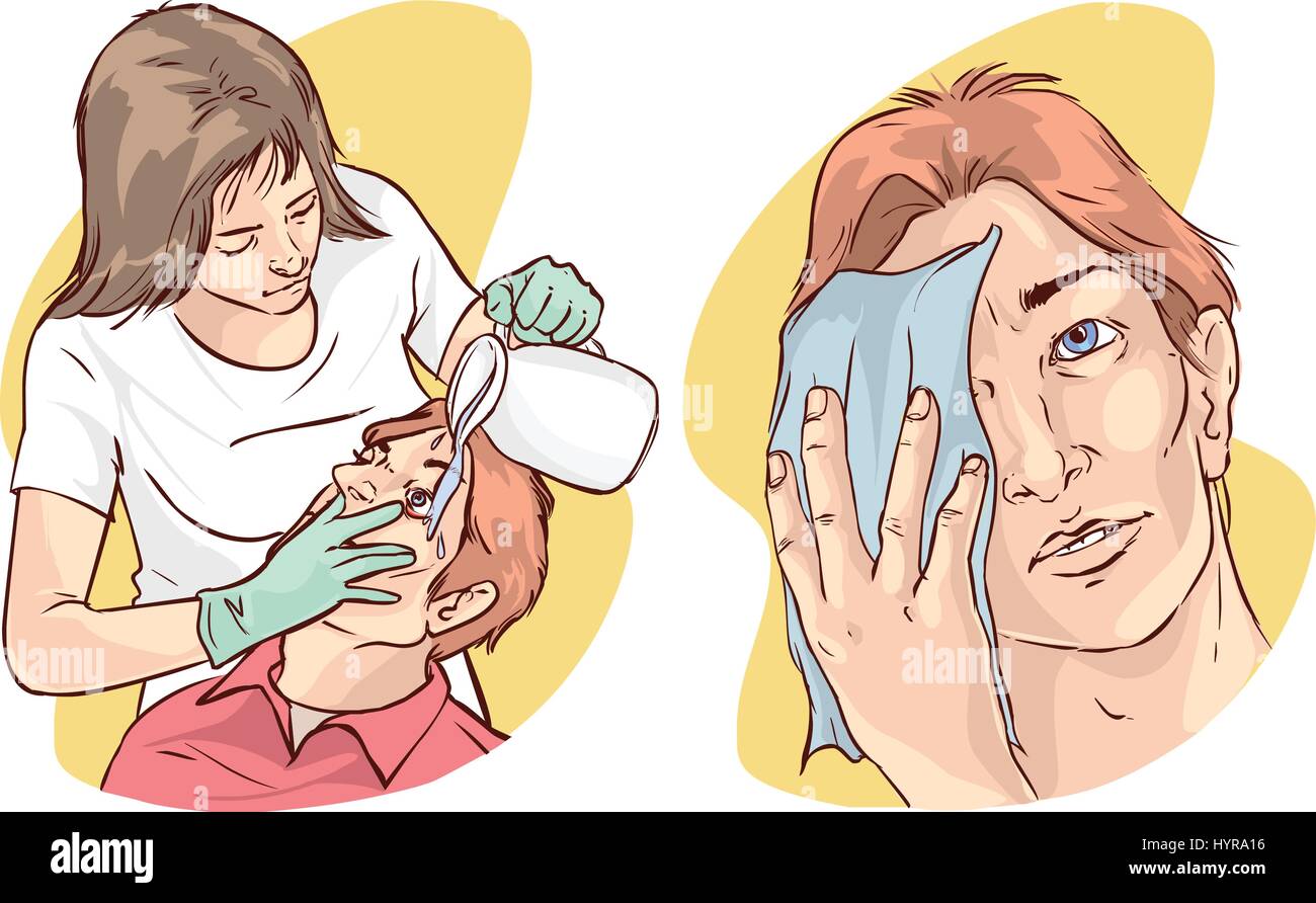 Illustrazione vettoriale di un infermiere il lavaggio del paziente gli occhi con acqua Illustrazione Vettoriale