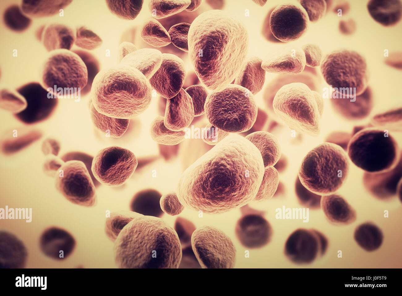 La diffusione delle cellule tumorali e la crescita di cellule maligne in un corpo umano Foto Stock