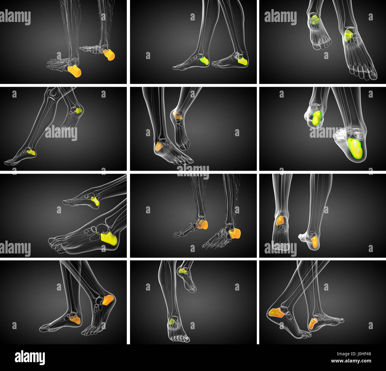 Rendering 3d Illustrazione medica del calcagno osso Foto Stock