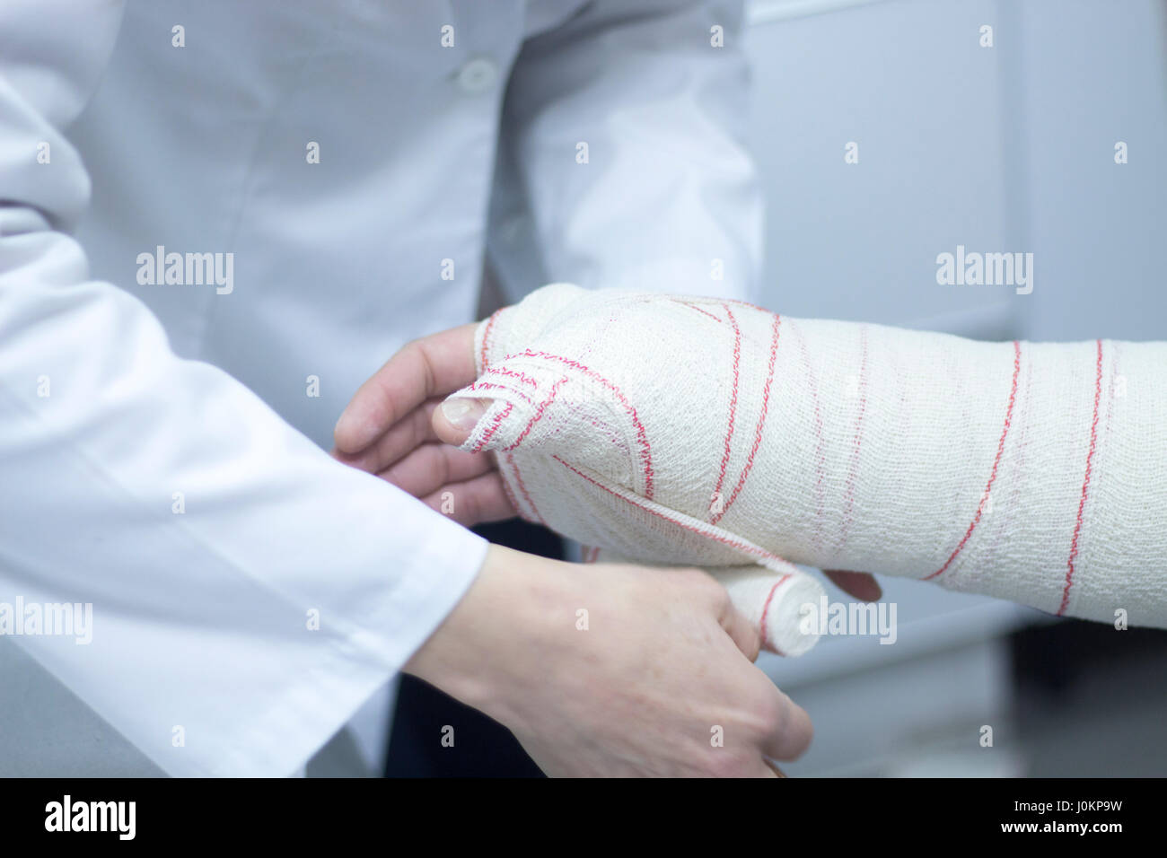 Medico applicando un calco in gesso e bende per paziente avambraccio e  polso per immobilizzare dopo la frattura del pregiudizio Foto stock - Alamy