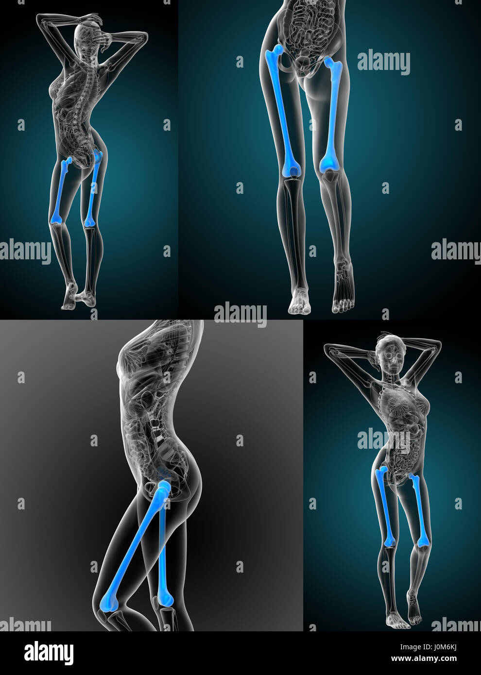 Rendering 3d Illustrazione medica dell'osso del femore Foto Stock