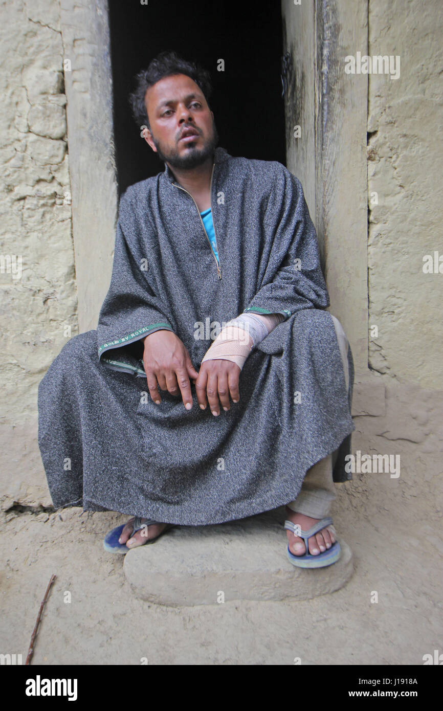 Farooq Ahmed dar, che è stata usata come scudo umano da esercito indiano di reggette da lui a una jeep il 9 aprile 2017. (Foto: Umer Asif/Pacific Stampa) Foto Stock