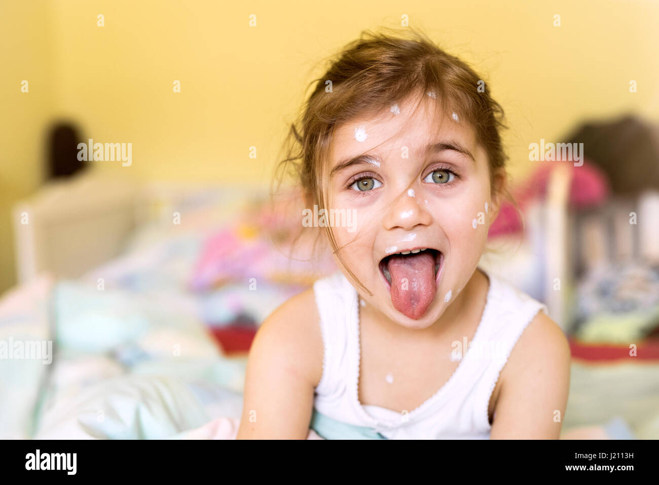 Ritratto di ragazza con la varicella in casa Foto Stock