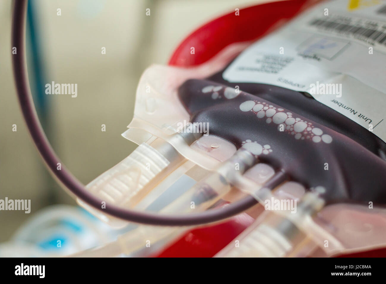 Sacca di sangue ottenuto da donazioni di sangue Foto Stock