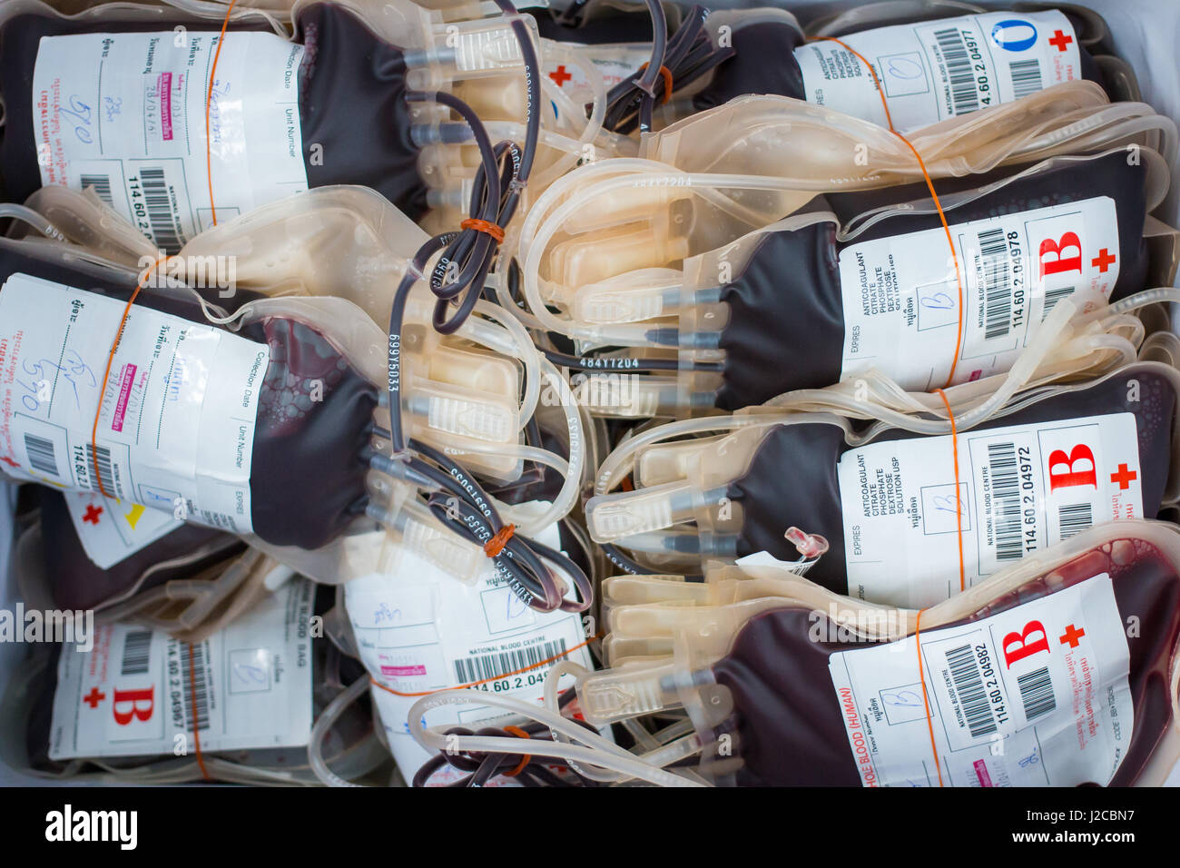Sacca di sangue ottenuto da donazioni di sangue Foto Stock