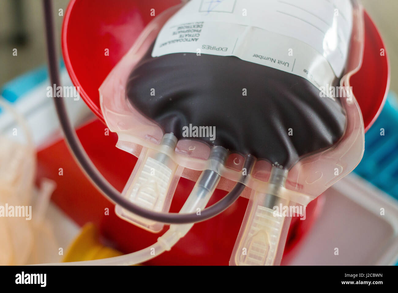 Sacca di sangue ottenuto da donazioni di sangue Foto Stock