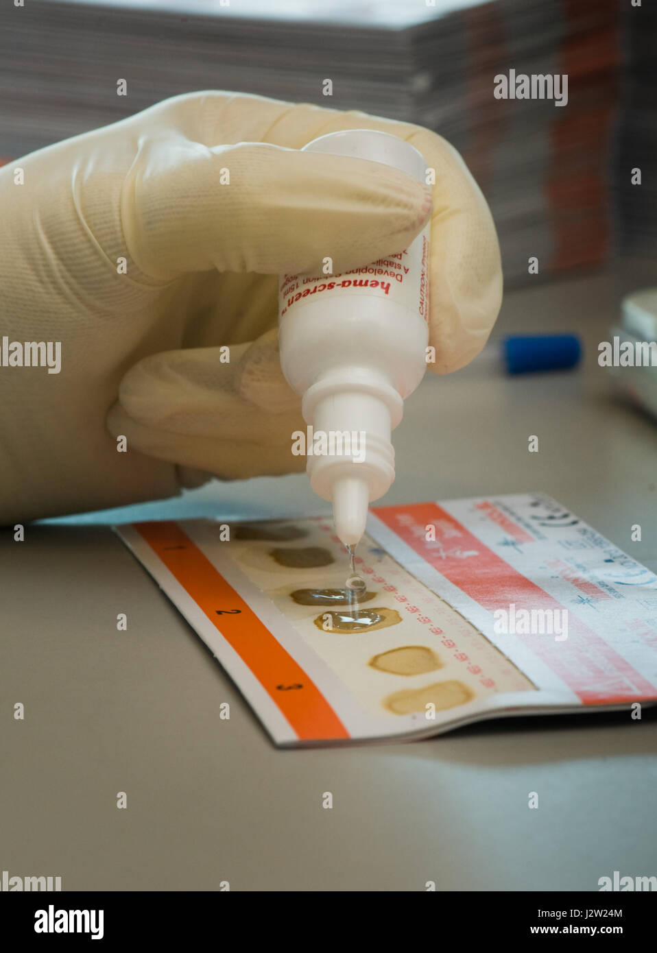 Test di campioni fecali su un intestino scheda di screening per la presenza di occulta (nascosta) sangue Foto Stock