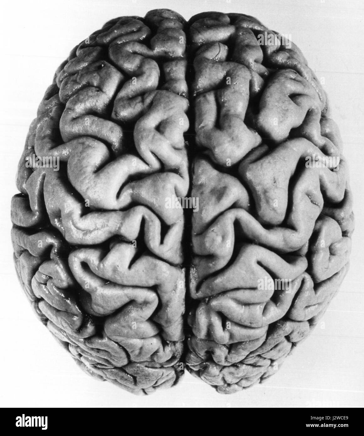 Il termine facies dorsalis cerebri si riferisce alla superficie dorsale del cervello, in particolare all'area visibile dall'alto. È una caratteristica anatomica studiata in neuroscienze e neurologia per comprendere la struttura e la funzione cerebrale. Foto Stock