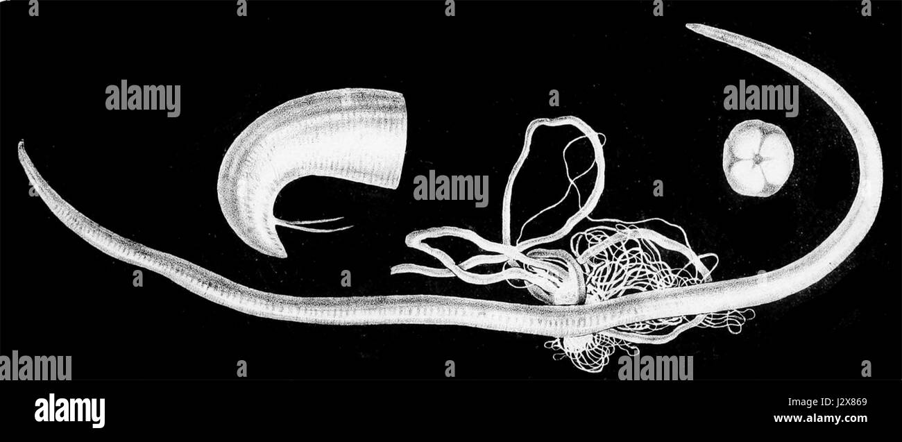 Ascaris lumbricoides è un parassita rombo che colpisce gli esseri umani, causando l'ascariasi della malattia. È uno dei vermi intestinali più comuni a livello mondiale, trasmesso attraverso cibo e acqua contaminati. Foto Stock