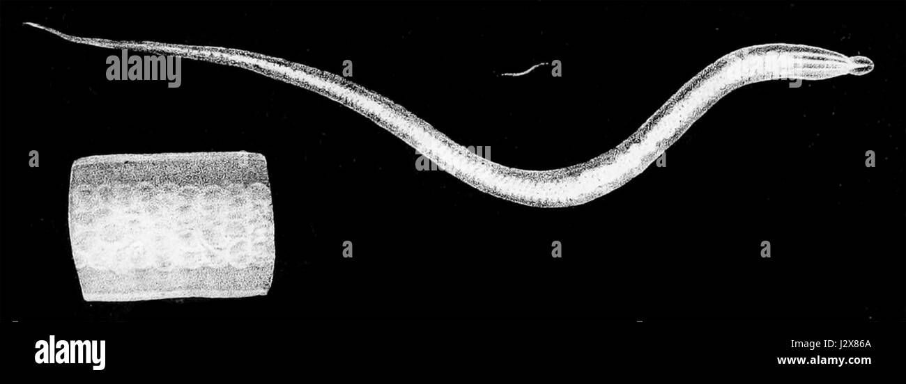 Gli Ascaris lumbricoides2 Foto Stock