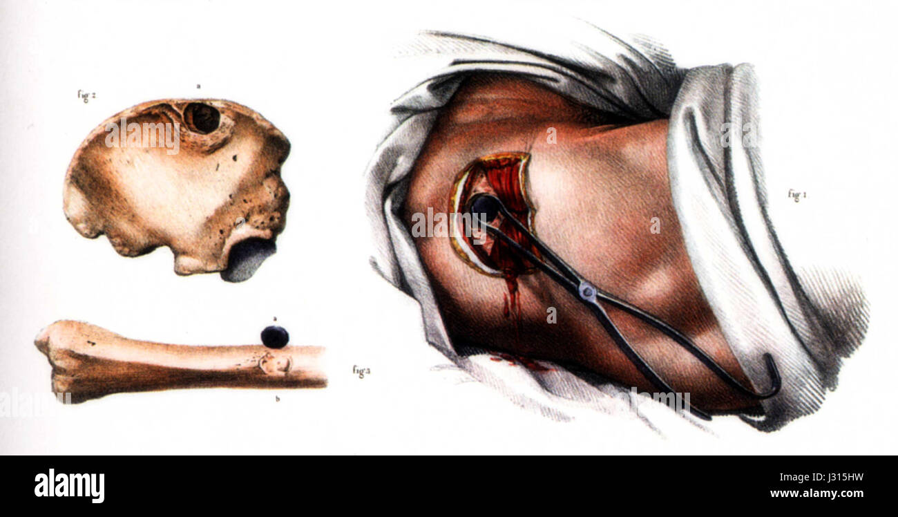 "Bourgery Chir Schuss" è probabilmente un riferimento a un'opera nel campo della scienza o dell'illustrazione medica. Può riferirsi a rappresentazioni storiche di studi anatomici o fisiologici. Foto Stock