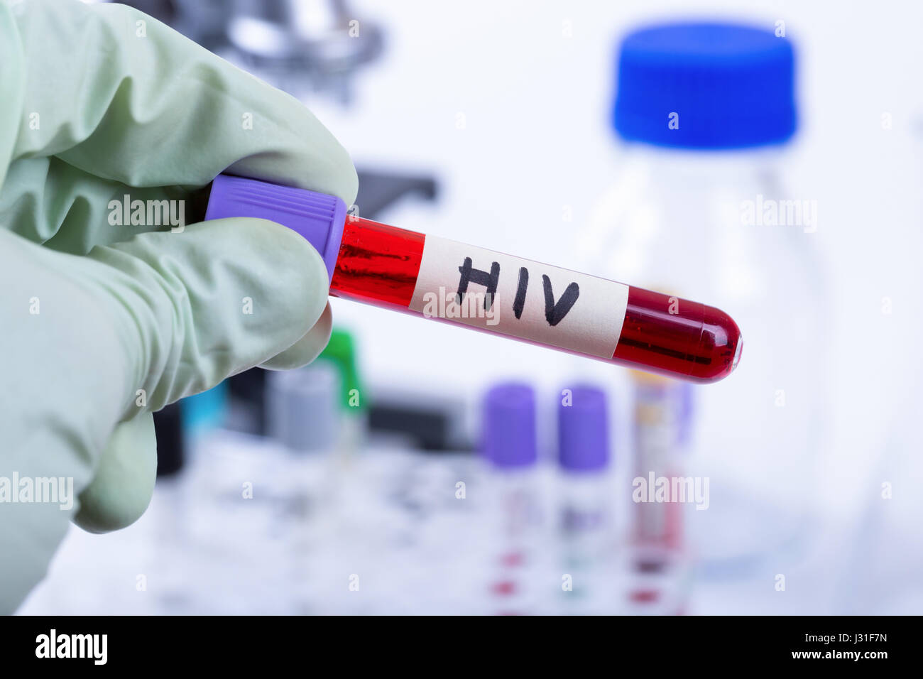 Mano che tiene il tubo con il campione di sangue per il test HIV Foto Stock