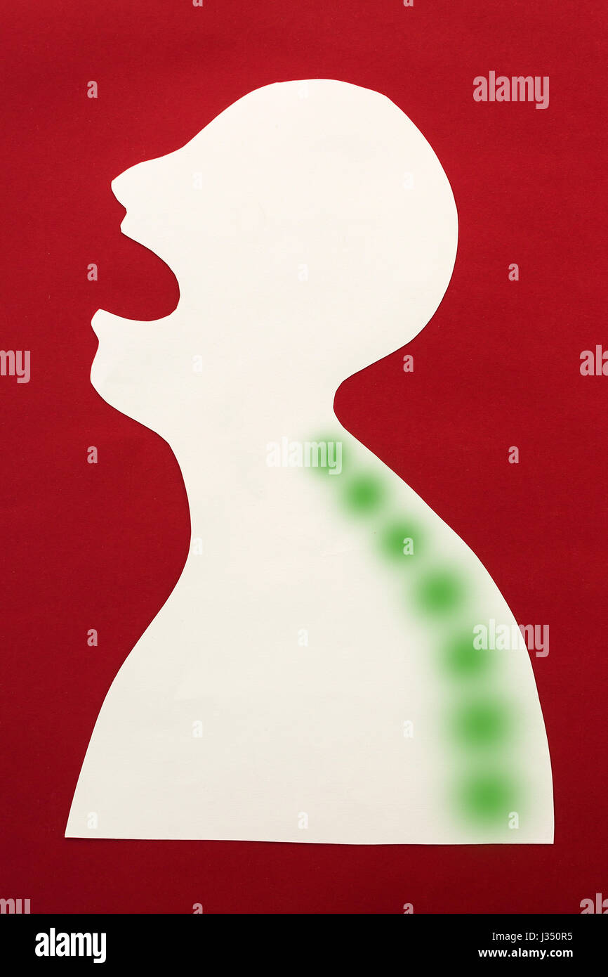 Concetto di malattia umana e dolore localizzazione su silhouette - corpo astratto, trattamento medico della colonna vertebrale, cambiamenti positivi nella storia di guarigione, isolato su sfondo rosso, vista dall'alto, laici piatta Foto Stock