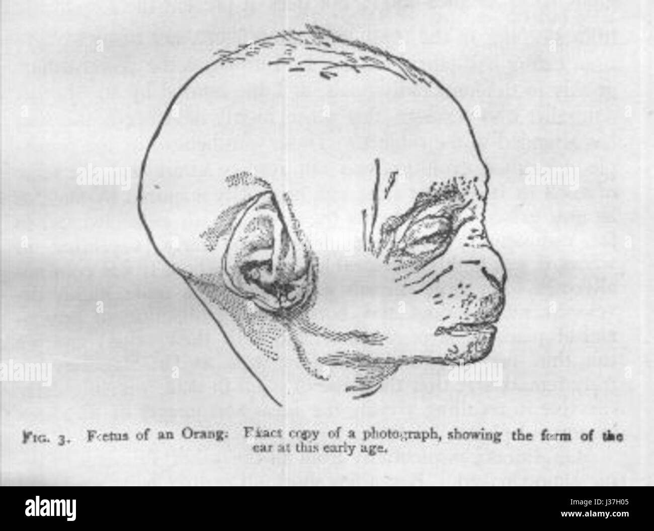 Questo si riferisce a un'illustrazione medica o scientifica che raffigura la discesa di un feto orangutano durante la gravidanza. L'immagine mostra le fasi di sviluppo del feto nell'utero. Foto Stock