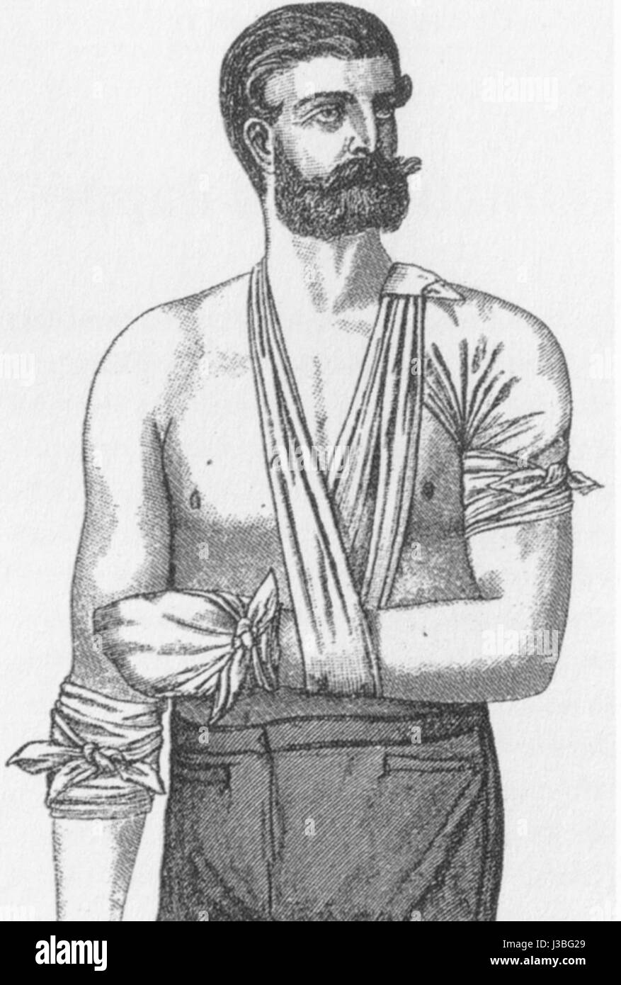 La Esmarch Erste Hilfe Tuch 01 Foto Stock