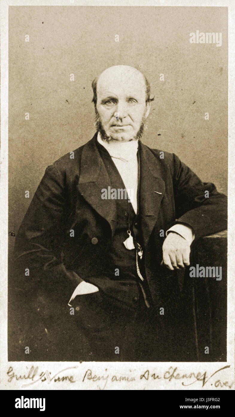 Un'illustrazione medica raffigurante i sintomi della distrofia muscolare di Duchenne, evidenziando debolezza muscolare e degenerazione. L'immagine funge da strumento educativo per comprendere la condizione. Foto Stock