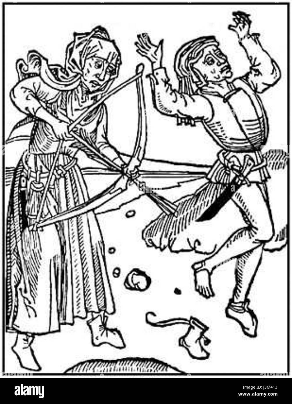 Â€˜Hexenschuss,â€™ una xilografia di Johann Zainer, raffigurante la patologia dolorosa nota come sciatica o lumbago, comune nei contesti medici e culturali europei medievali. Foto Stock