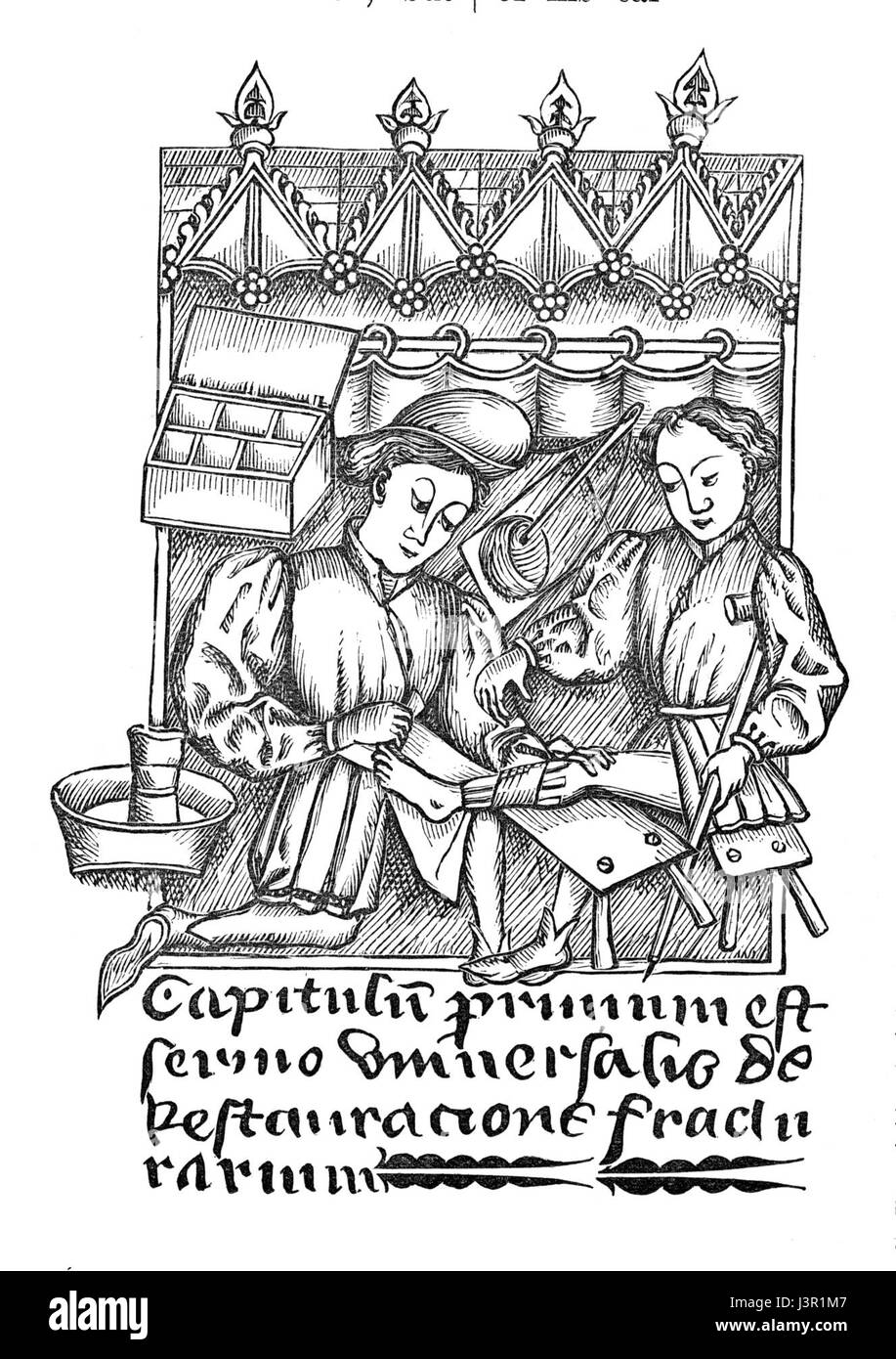 Illustrazione di un quattordicesimo secolo MS in sulla chirurgia nella biblioteca della città Bristol 2 Foto Stock