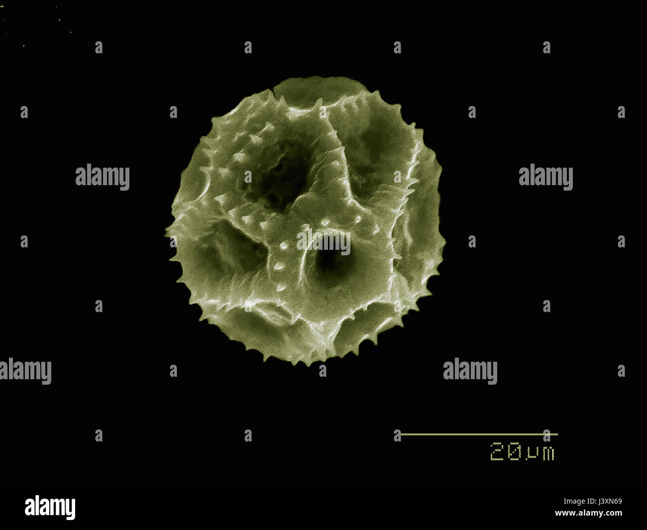Tarassaco il polline imaging in un microscopio elettronico a scansione Foto Stock Tarassaco il polline imaging in un microscopio elettronico a scansione Foto Stock