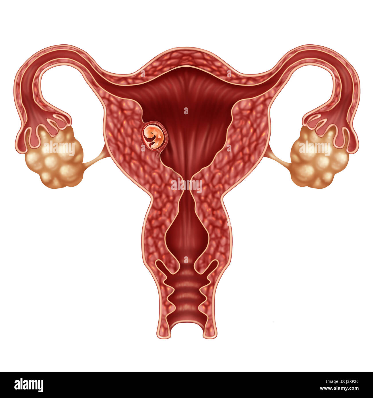 Impiantato embrione umano concetto e gravidanza riuscita l'impianto in utero come un feto in crescita in un corpo femminile come un ostetrico. Foto Stock