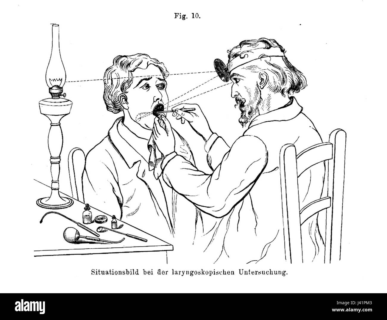 Laringoscopia è una procedura medica utilizzata per esaminare la laringe (casella vocale) e le aree circostanti della gola. Viene spesso eseguita per diagnosticare problemi come infezioni, tumori o disturbi della voce. Foto Stock