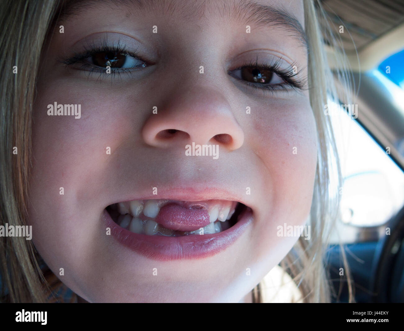 Una ragazza bastoni la sua linguetta attraverso lo spazio vuoto lasciato dalla sua denti mancanti. Foto Stock