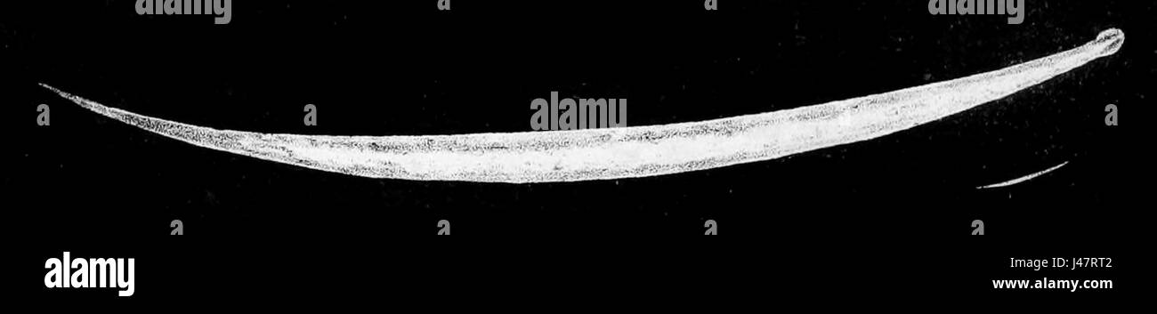 Oxyuris vermicularis, comunemente noto come pinworm, è un nematode parassitario. La femmina è tipicamente caratterizzata dal suo corpo lungo e sottile e svolge un ruolo chiave nel ciclo di vita del parassita. Foto Stock