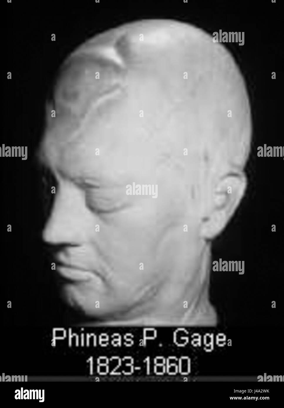 Phineas P Gage Maschera di vita Foto Stock