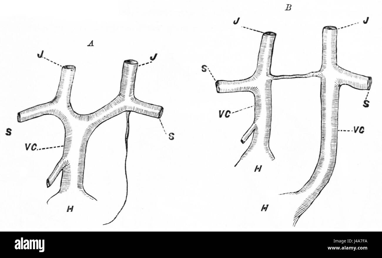 Questo si riferisce a un lavoro scientifico o medico, possibilmente da Popular Science Monthly, volume 25, figura D747. Il lavoro discute le strutture venose normali e anormali nel corpo umano. Foto Stock