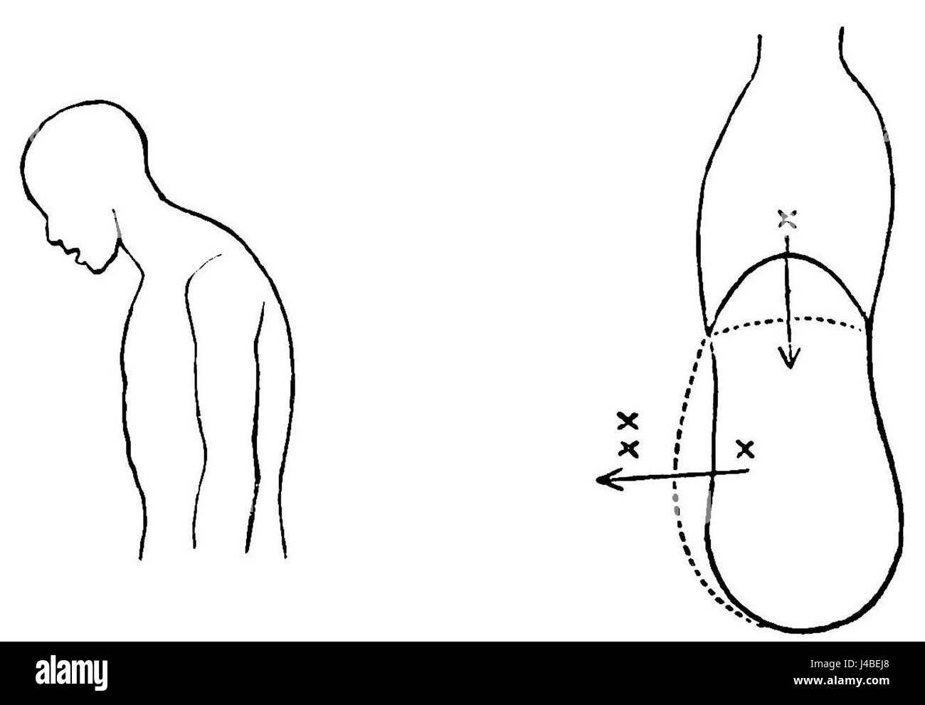 Un articolo o uno studio scientifico sugli effetti della tosse sulla zona addominale, tratto dalla pubblicazione PSM V42. Foto Stock