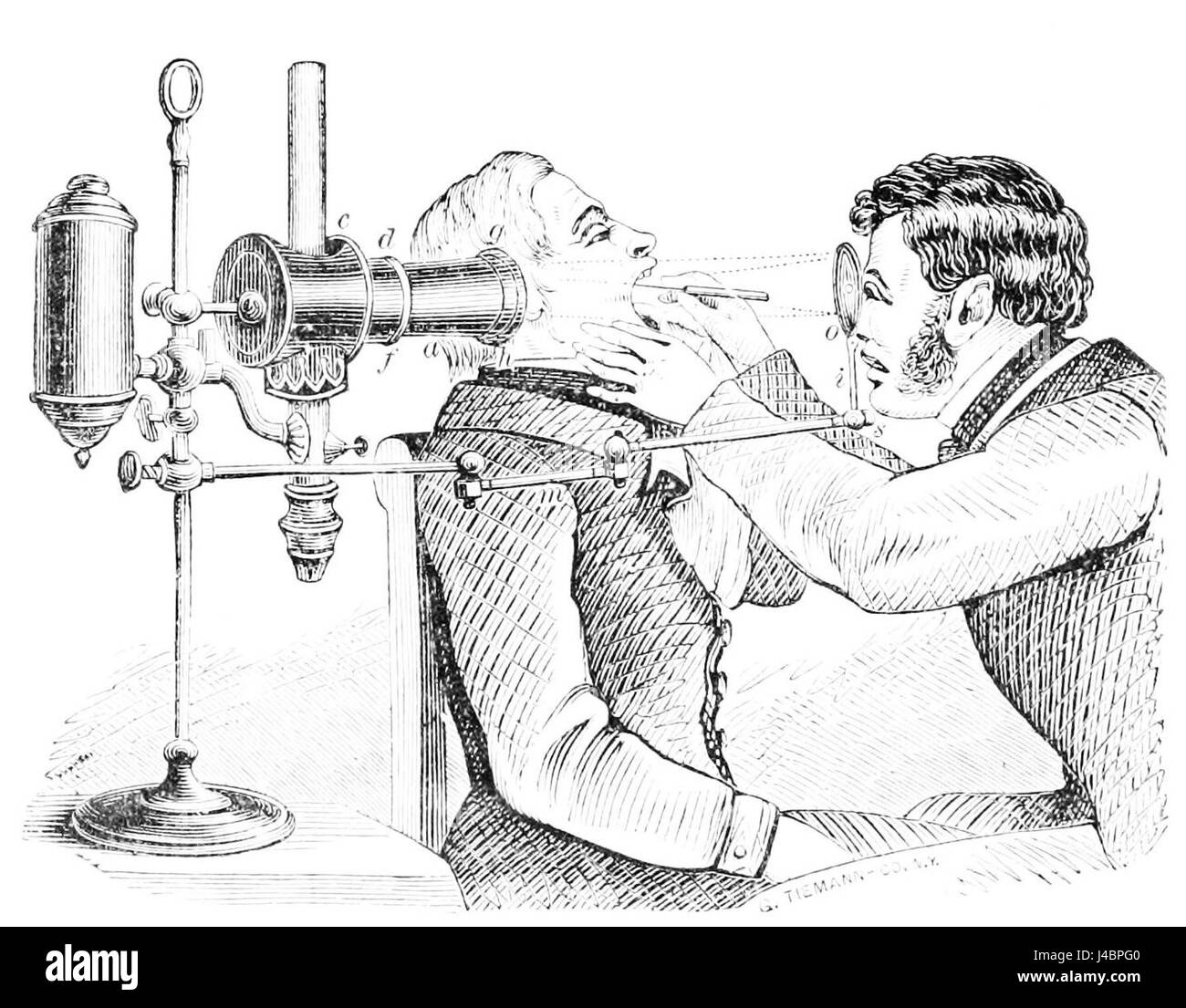 PSM V12 D182 si riferisce a un'illustrazione medica del Popular Science Monthly, raffigurante un esame laringeo dettagliato. L'illustrazione fornisce informazioni sull'anatomia della gola umana, concentrandosi sulle strutture coinvolte nella conversazione e nella respirazione. Foto Stock