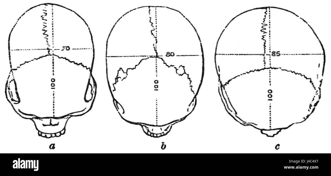 PSM V19 D305 offre una vista dall'alto dei crani di varie razze, fornendo uno studio anatomico comparato. Questa illustrazione aiuta a comprendere la diversità umana e la biologia evolutiva. Foto Stock
