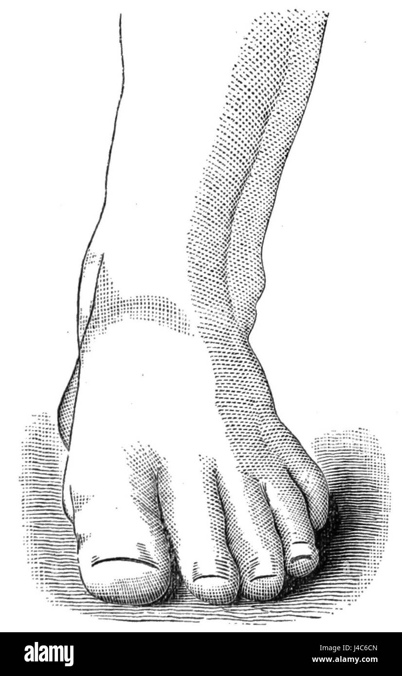 Questa immagine o descrizione si riferisce probabilmente a un'illustrazione dettagliata di un piede umano ben formato e sano, probabilmente proveniente dal "Museo della Scuola pubblica" o da un'altra fonte educativa. Sottolinea le caratteristiche anatomiche e l'importanza di una corretta salute del piede. Foto Stock