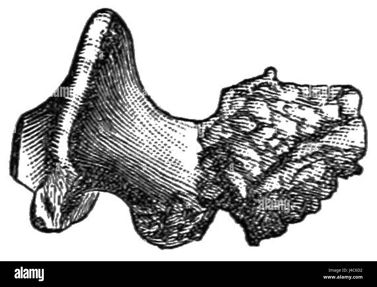 L'immagine rappresenta un'illustrazione in Popular Science Monthly, che descrive l'esosi, una condizione caratterizzata dalla crescita anomala del tessuto osseo. Questa rappresentazione si concentra sugli aspetti medici e sull'impatto di questa condizione sulla salute umana. Foto Stock