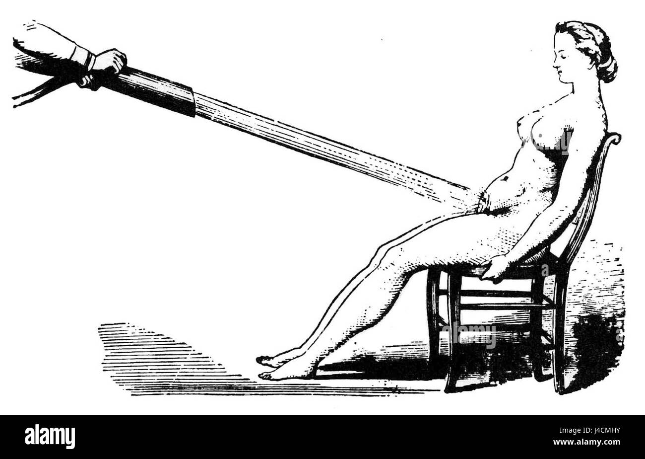 Pelvicdouche è un termine medico che si riferisce ad una procedura terapeutica che coinvolge l'irrigazione della cavità pelvica. Questa procedura viene utilizzata in alcuni trattamenti ginecologici per pulire l'area pelvica. Foto Stock