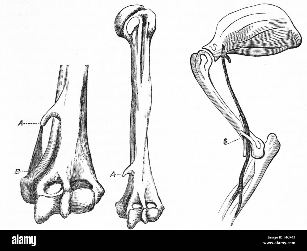 PSM V25 D743 Supracondyloid legamento e forame felino Foto Stock