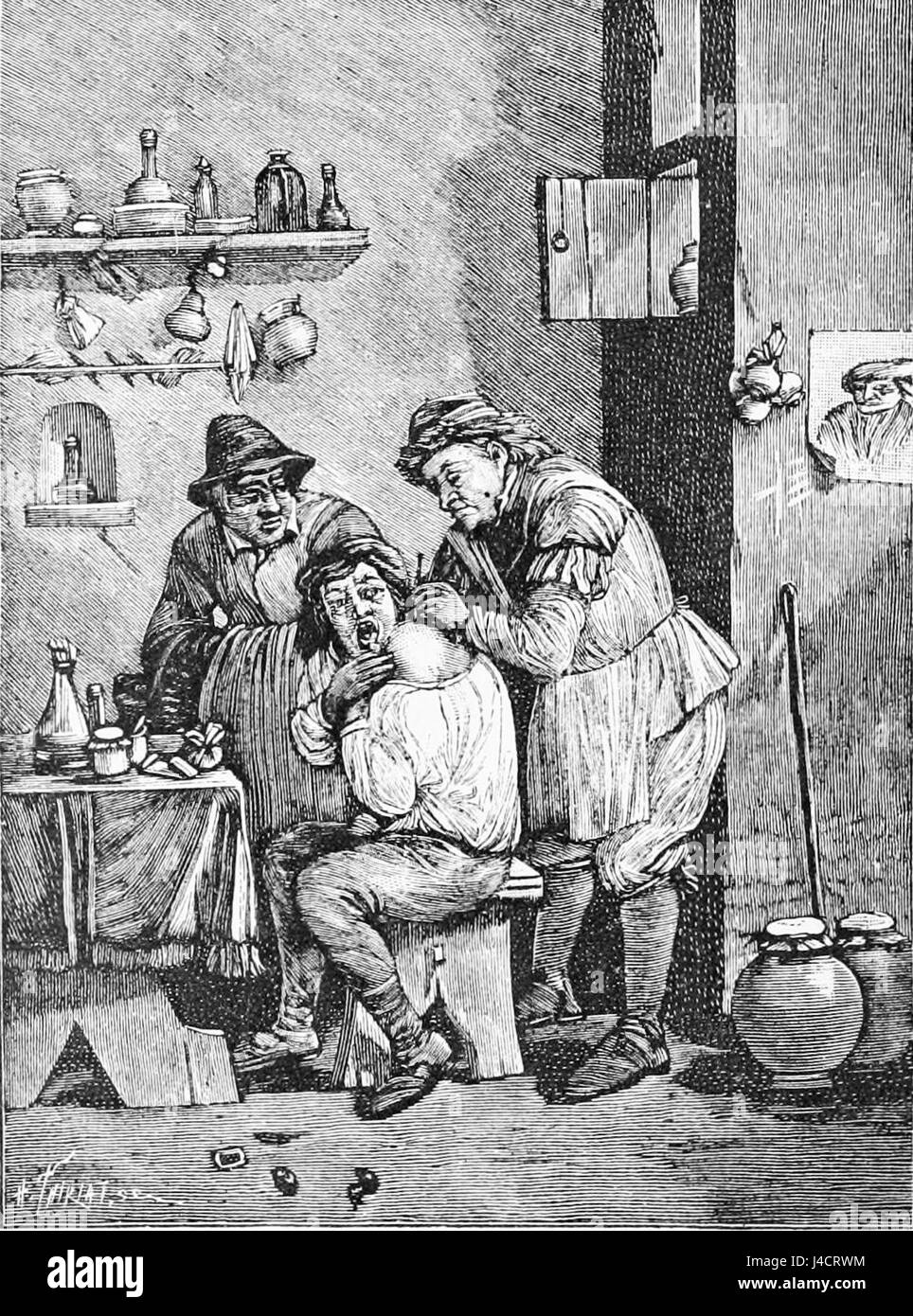 Questa illustrazione del PSM V48 D905 raffigura un chirurgo ciarlatano del XVIII secolo. Essa mette in evidenza il contesto storico della medicina precoce e la prevalenza di medici senza licenza e fraudolenti durante quel periodo. Foto Stock