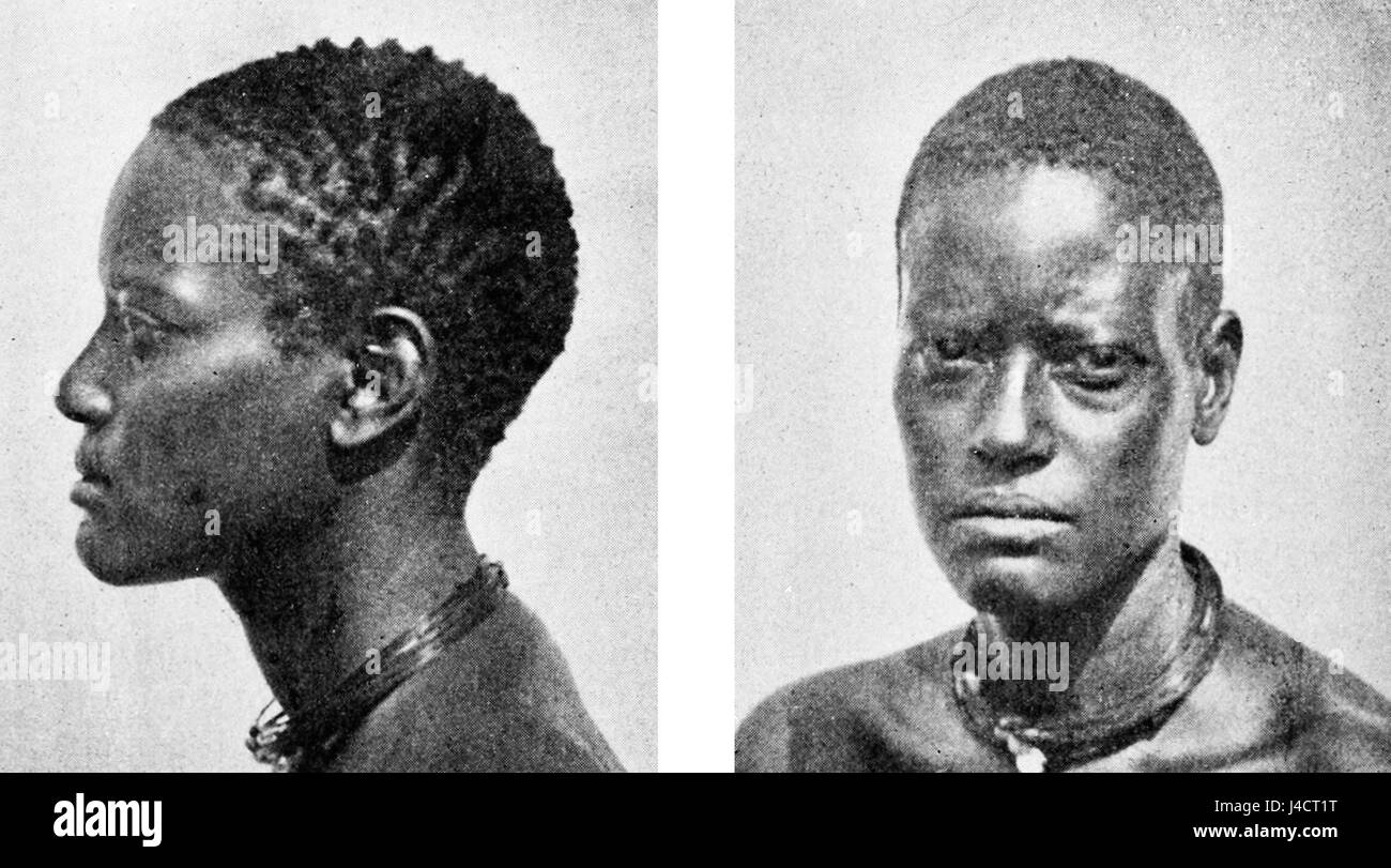 Spazio cefalico immagini e fotografie stock ad alta risoluzione Alamy