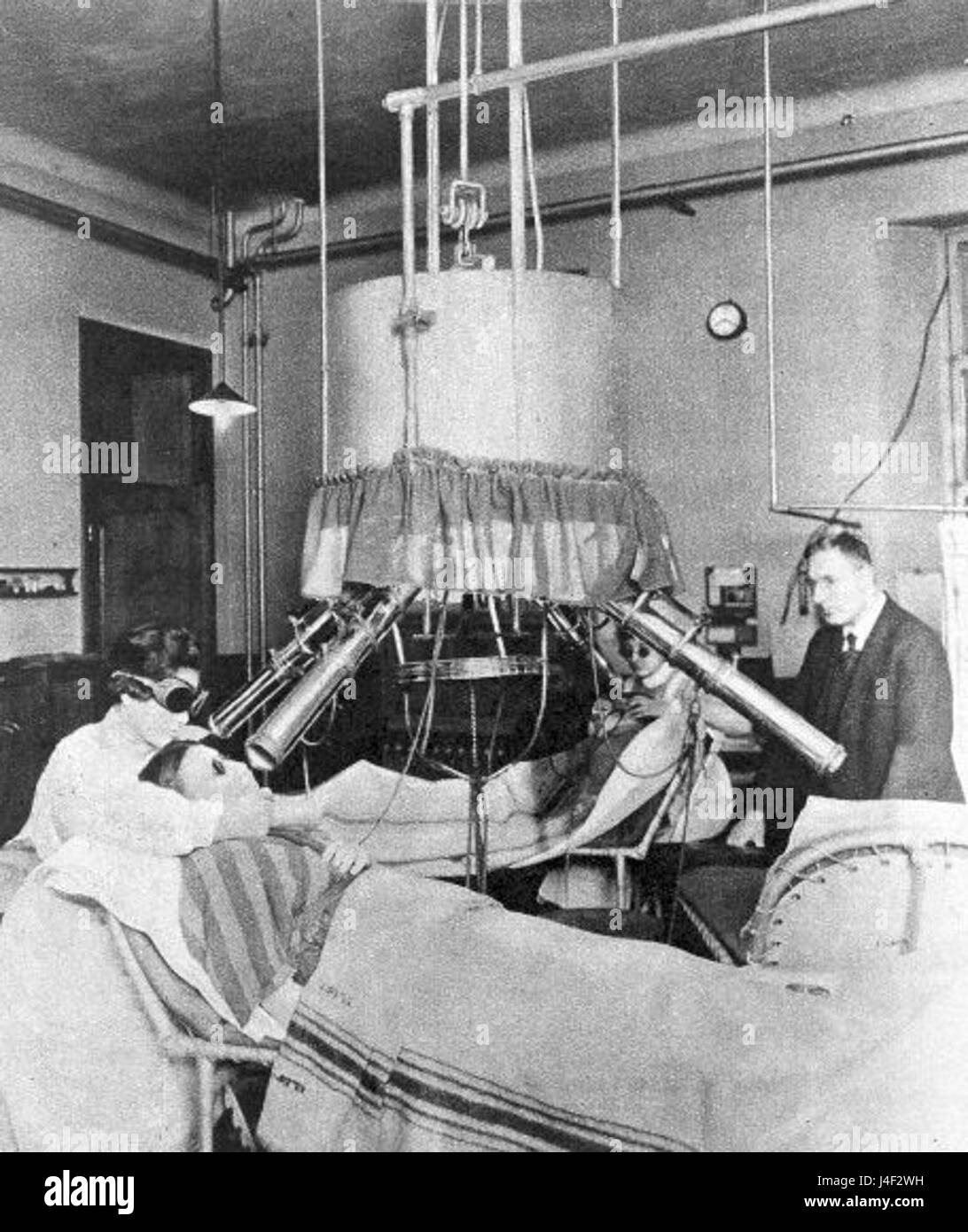 Lampada Finsen trattamento Londra 1925 Foto Stock