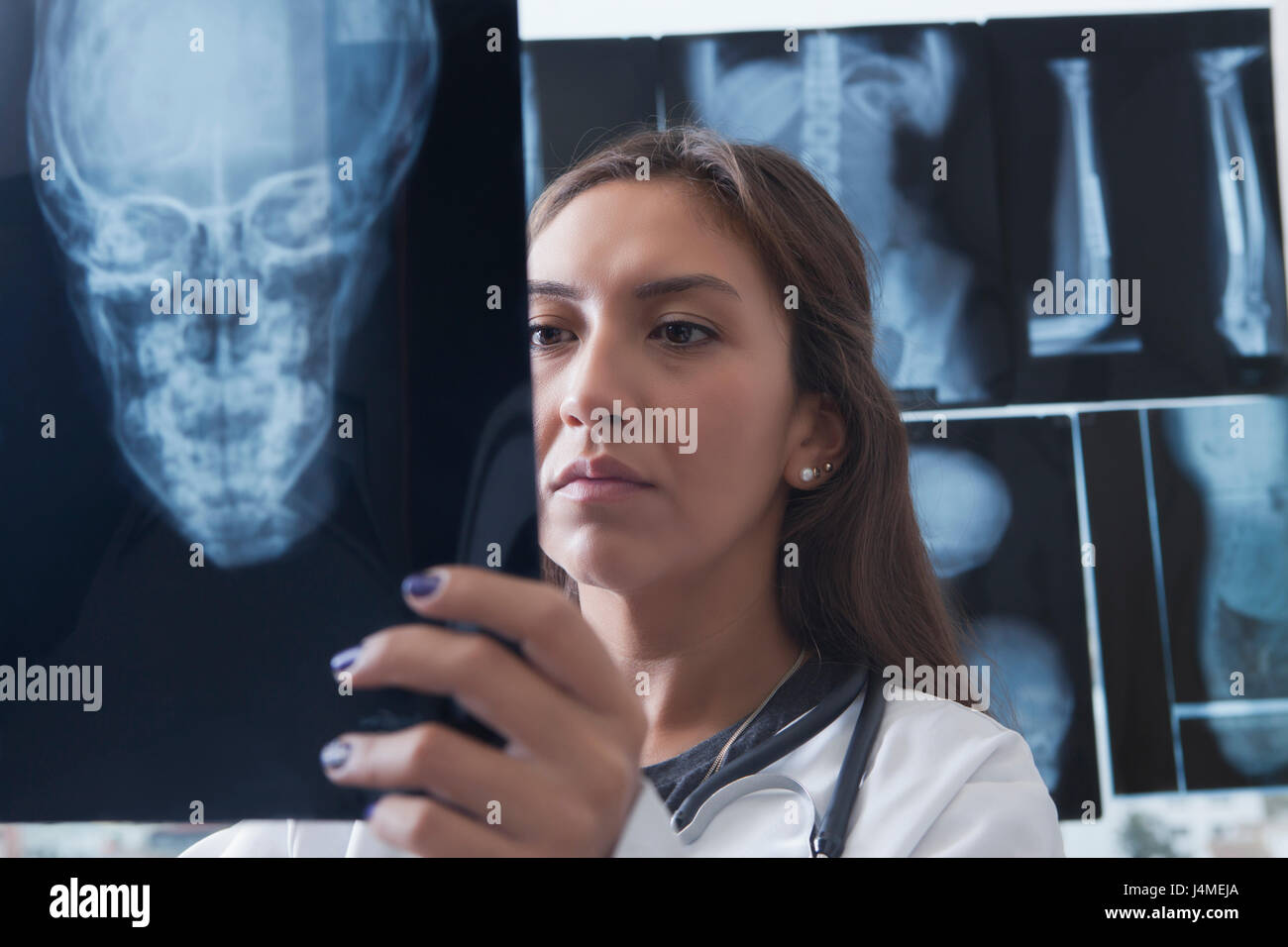 Medico di origine ispanica esaminando a raggi x del cranio Foto Stock