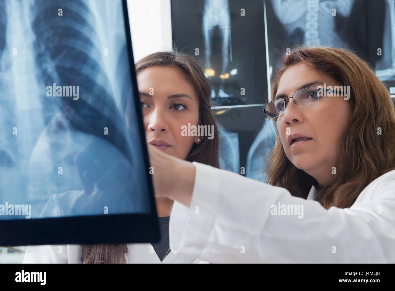 Medici ispanica esaminando a raggi x del torace Foto Stock