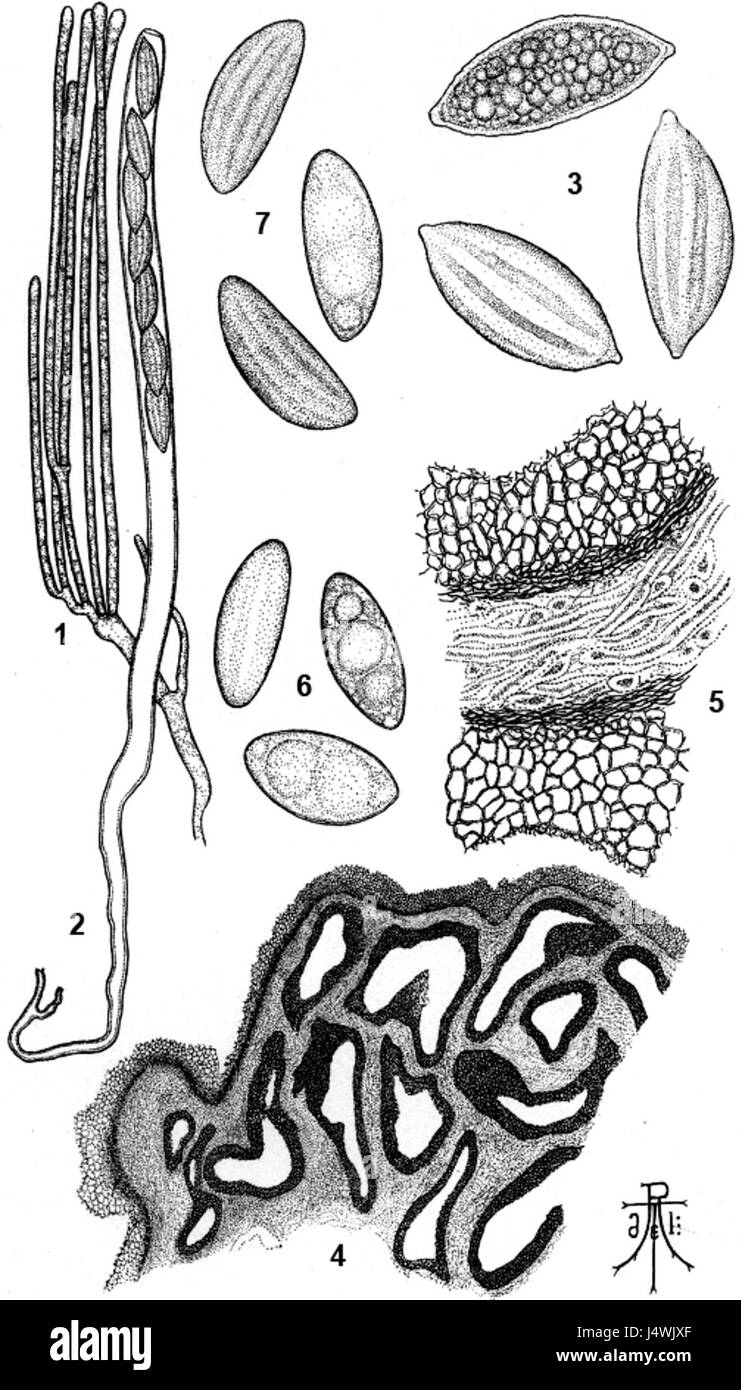 Wynnea americana caratteristiche microscopiche da Thaxter 1905 Foto Stock