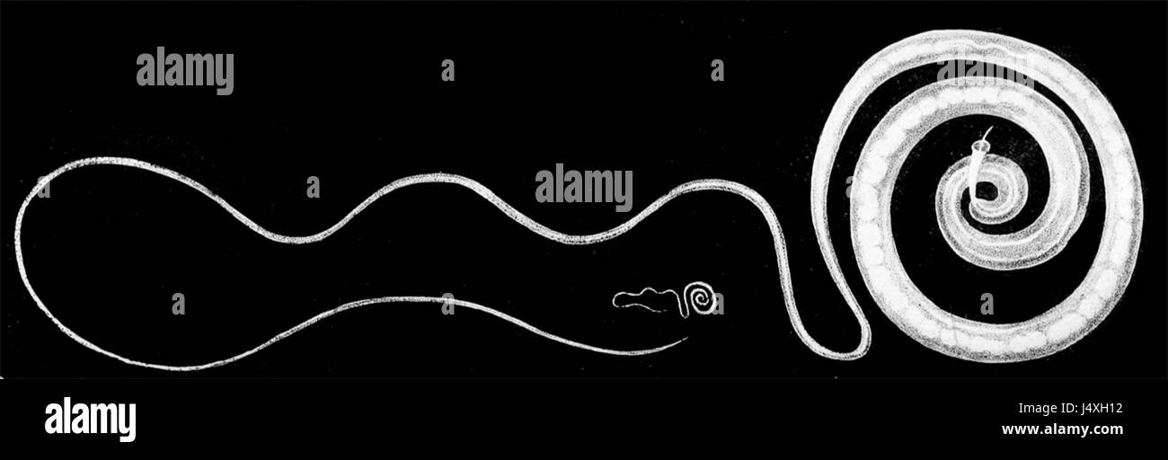 Trichuris trichiura Foto Stock