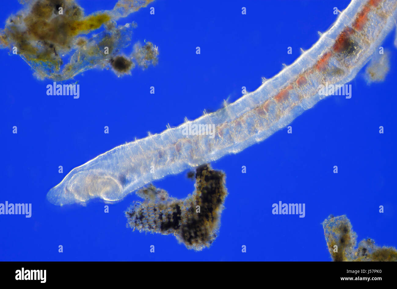 Vista microscopico di Oligochaete worm. Rheinberg illuminazione. Foto Stock