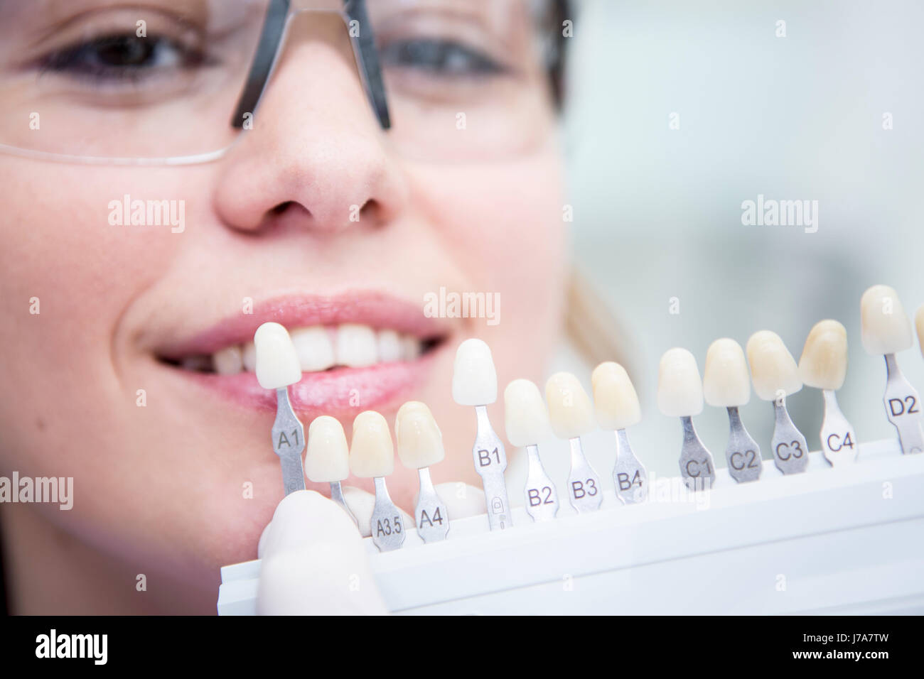 Donna al dentista scegliendo il colore per lo sbiancamento dei denti Foto  stock - Alamy