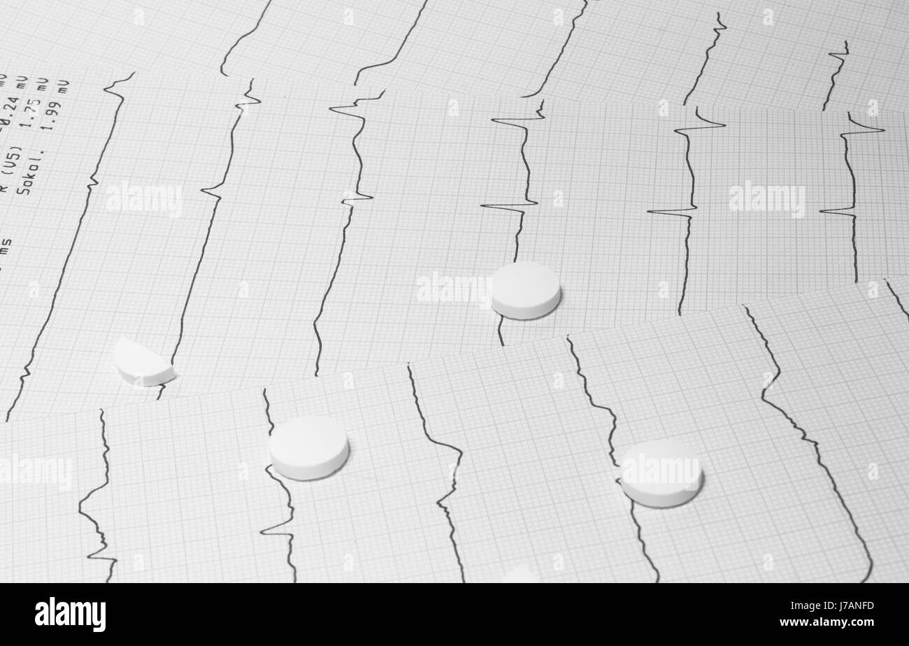 ECG Foto Stock