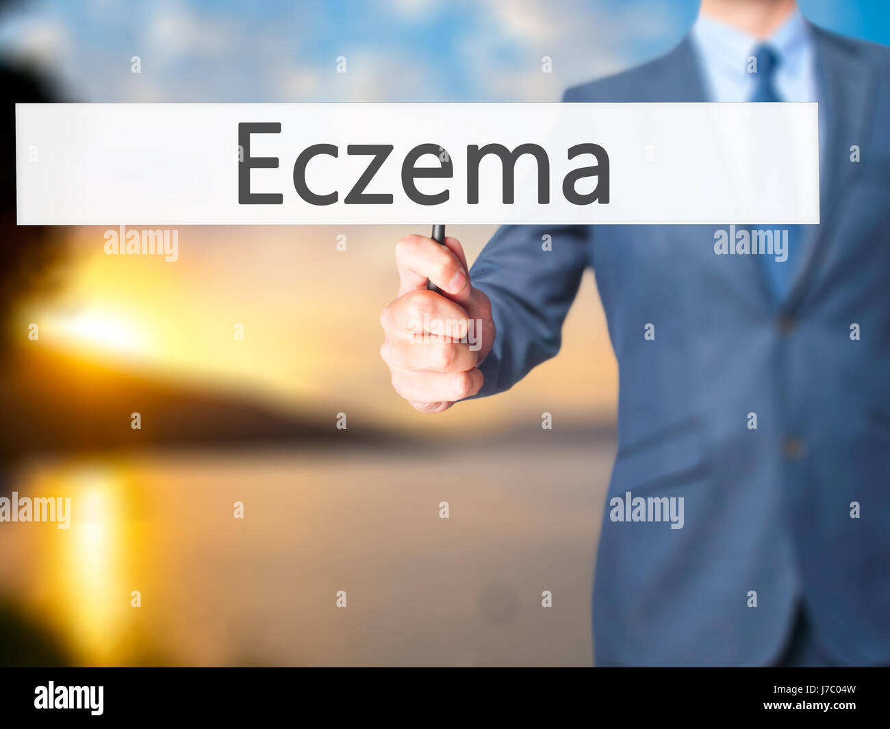 Eczema - Imprenditore mano azienda segno. Business, tecnologia internet concetto. Stock Photo Foto Stock